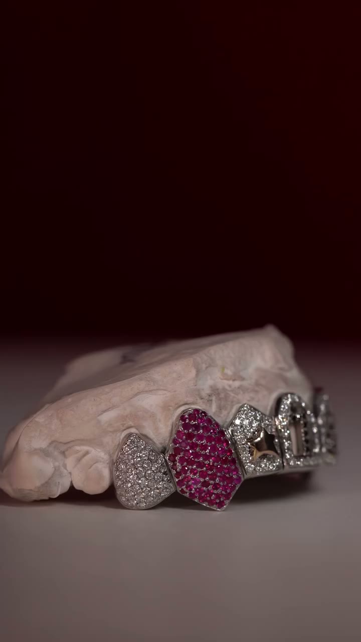 Diamond grillz
